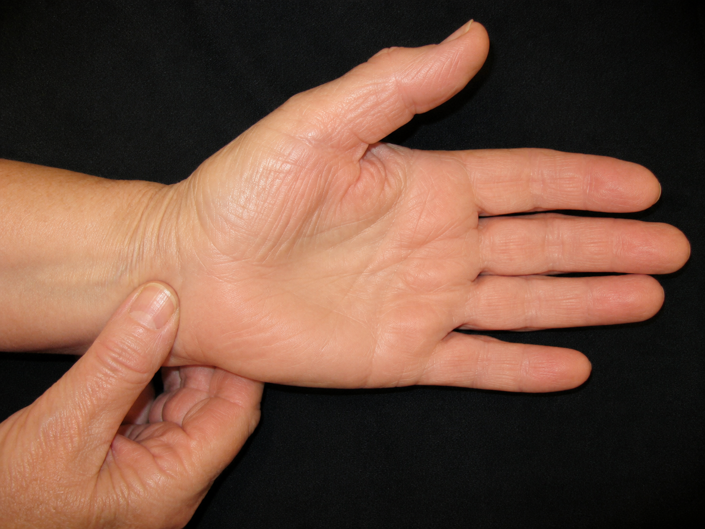 Carpal tunnel syndrome examination