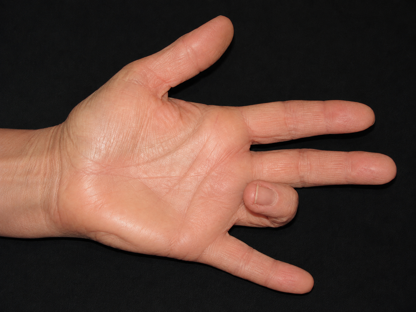 Palm-Up Hand with Flexed Ring Finger