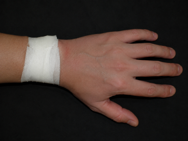 sports-injury